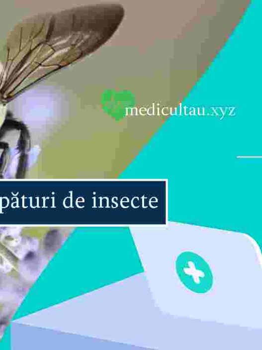 Alergiile la înțepături de insecte Cauze, simptome și management